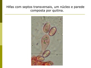 Hifas com septos transversais, um núcleo e parede
               composta por quitina.
 