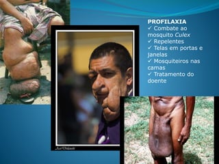 PROFILAXIA
 Combate ao
mosquito Culex
 Repelentes
 Telas em portas e
janelas
 Mosquiteiros nas
camas
 Tratamento do
doente
 