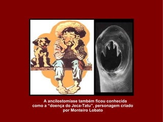 A ancilostomíase também ficou conhecida  como a “doença do Jeca-Tatu”, personagem criado  por Monteiro Lobato 