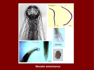 Necator americanus 