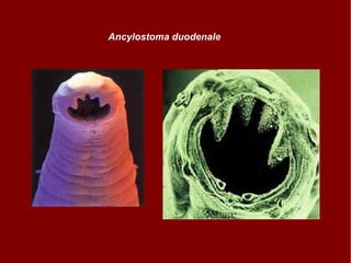 Ancylostoma duodenale 