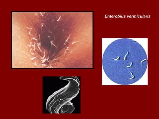 Enterobius vermicularis 