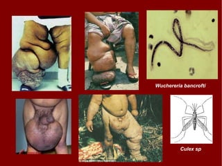 Wuchereria bancrofti Culex sp 