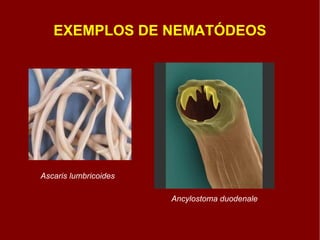 EXEMPLOS DE NEMATÓDEOS Ascaris lumbricoides Ancylostoma duodenale 