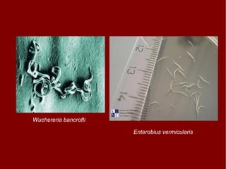 Wuchereria bancrofti Enterobius vermicularis 