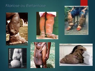 Filo nematodea nematelmintos