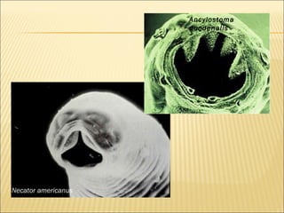 Ancylostoma
                     duodenalis




Necator americanus
 