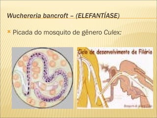 Wuchereria bancroft – (ELEFANTÍASE)

   Picada do mosquito de gênero Culex:
 