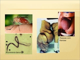 Culex



                       Pessoas com
                       filariose




Wuchereria bancrofti
 