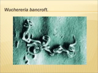 Wuchereria bancroft.
 