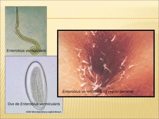 Enterobius vermicularis




                                 Enterobius vermicularis na região perianal


Ovo de Enterobius vermicularis
 