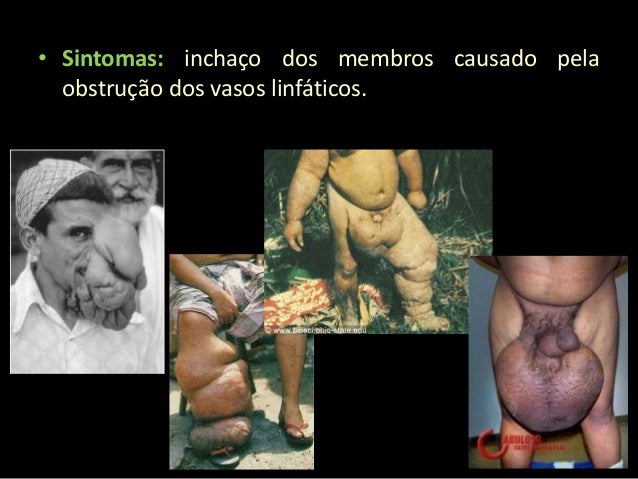 Muitos parasitas têm a estrutura de corpo simplificada em comparação com
