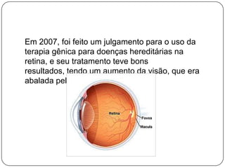 Em 2007, foi feito um julgamento para o uso da
terapia gênica para doenças hereditárias na
retina, e seu tratamento teve bons
resultados, tendo um aumento da visão, que era
abalada pela doença.
 