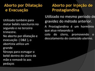 Aborto por Dilatação            Aborto por injeção de
e Evacuação                     Prostaglandina
                            Utilizado no mesmo período de
Utilizado também para       gravidez do método anterior.
matar bebês nascituros no
segundo e no terceiro       A Prostaglandina é um hormônio
trimestre.                  que atua relaxando o
No aborto por dilatação e   colo do útero, promovendo o
evacuação ( D&E ), o        descolamento do conteúdo uterino.
abortista utiliza um
grande
fórceps para esmagar o
bebê dentro do útero da
mãe e removê-lo aos
pedaços
 