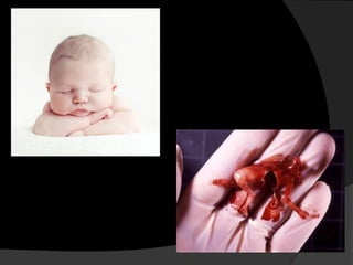  aborto