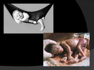  aborto