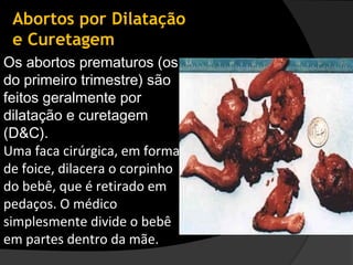 Abortos por Dilatação
 e Curetagem
Os abortos prematuros (os
do primeiro trimestre) são
feitos geralmente por
dilatação e curetagem
(D&C).
Uma faca cirúrgica, em forma
de foice, dilacera o corpinho
do bebê, que é retirado em
pedaços. O médico
simplesmente divide o bebê
em partes dentro da mãe.
 