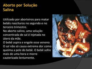 Aborto por Solução
Salina

Utilizado por aborteiros para matar
bebês nascituros no segundo e no
terceiro trimestre.
No aborto salino, uma solução
concentrada de sal é injetada no
útero da mãe.
O bebê aspira e engole esse veneno.
O sal não só causa extrema dor como
queima a pele do bebê. O bebê sofre
mais de uma hora e morre
cauterizado lentamente.
 