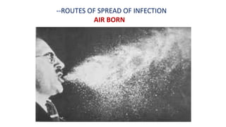 --ROUTES OF SPREAD OF INFECTION
AIR BORN
 