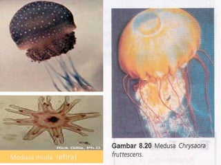 Medusa muda (efira)
 