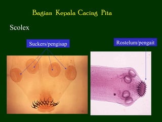 Bagian Kepala Cacing Pita

Scolex

     Suckers/pengisap                Rostelum/pengait
 