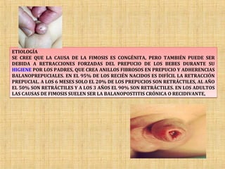 ETIOLOGÍA
SE CREE QUE LA CAUSA DE LA FIMOSIS ES CONGÉNITA, PERO TAMBIÉN PUEDE SER
DEBIDA A RETRACCIONES FORZADAS DEL PREPUCIO DE LOS BEBES DURANTE SU
HIGIENE POR LOS PADRES, QUE CREA ANILLOS FIBROSOS EN PREPUCIO Y ADHERENCIAS
BALANOPREPUCIALES. EN EL 95% DE LOS RECIÉN NACIDOS ES DIFÍCIL LA RETRACCIÓN
PREPUCIAL. A LOS 6 MESES SOLO EL 20% DE LOS PREPUCIOS SON RETRÁCTILES, AL AÑO
EL 50% SON RETRÁCTILES Y A LOS 3 AÑOS EL 90% SON RETRÁCTILES. EN LOS ADULTOS
LAS CAUSAS DE FIMOSIS SUELEN SER LA BALANOPOSTITIS CRÓNICA O RECIDIVANTE,
 