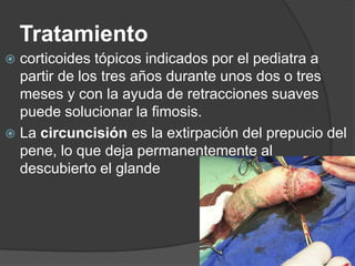 Tratamiento
 corticoides tópicos indicados por el pediatra a
  partir de los tres años durante unos dos o tres
  meses y con la ayuda de retracciones suaves
  puede solucionar la fimosis.
 La circuncisión es la extirpación del prepucio del
  pene, lo que deja permanentemente al
  descubierto el glande
 