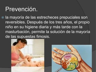 Prevención.
   la mayoría de las estrecheces prepuciales son
    reversibles. Después de los tres años, el propio
    niño en su higiene diaria y más tarde con la
    masturbación, permite la solución de la mayoría
    de las supuestas fimosis.
 