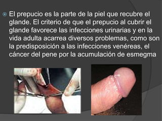    El prepucio es la parte de la piel que recubre el
    glande. El criterio de que el prepucio al cubrir el
    glande favorece las infecciones urinarias y en la
    vida adulta acarrea diversos problemas, como son
    la predisposición a las infecciones venéreas, el
    cáncer del pene por la acumulación de esmegma
 