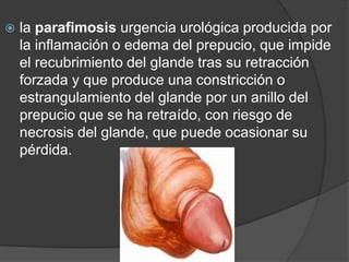    la parafimosis urgencia urológica producida por
    la inflamación o edema del prepucio, que impide
    el recubrimiento del glande tras su retracción
    forzada y que produce una constricción o
    estrangulamiento del glande por un anillo del
    prepucio que se ha retraído, con riesgo de
    necrosis del glande, que puede ocasionar su
    pérdida.
 