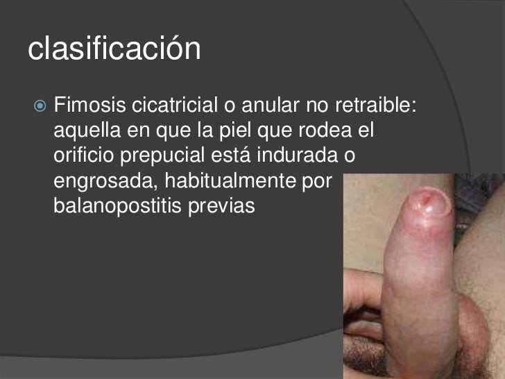 Como aumentar el miembro viril de la casa del ejercicio