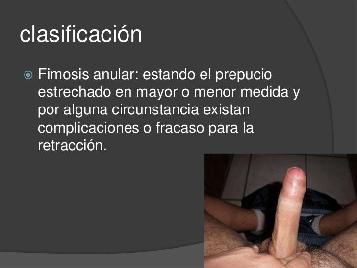 Kamasutra las poses si un pequeño miembro