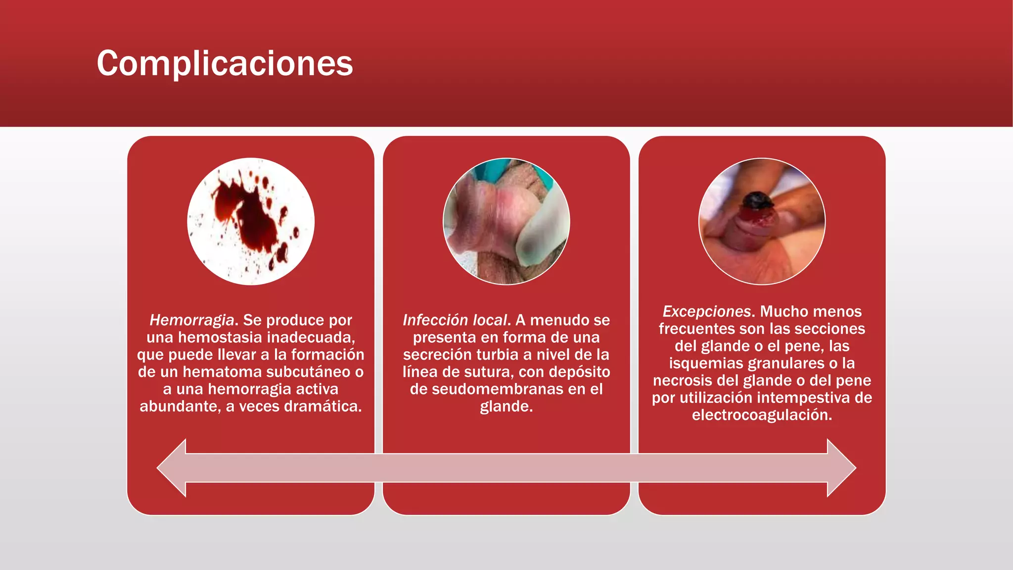 Fimosis en población pediátrica. | PPTX