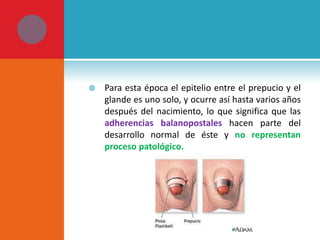 

Para esta época el epitelio entre el prepucio y el
glande es uno solo, y ocurre así hasta varios años
después del nacimiento, lo que significa que las
adherencias balanopostales hacen parte del
desarrollo normal de éste y no representan
proceso patológico.

 