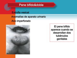 Pene bifido&doble
Extrofia vesical

Anomalías de aparato urinario
Ano imperforado
El pene bífido
aparece cuando se
desarrollan dos
tubérculos
genitales

 