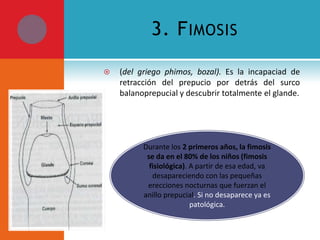 3. F IMOSIS


(del griego phimos, bozal). Es la incapaciad de
retracción del prepucio por detrás del surco
balanoprepucial y descubrir totalmente el glande.

Durante los 2 primeros años, la fimosis
se da en el 80% de los niños (fimosis
fisiológica). A partir de esa edad, va
desapareciendo con las pequeñas
erecciones nocturnas que fuerzan el
anillo prepucial. Si no desaparece ya es
patológica.

 