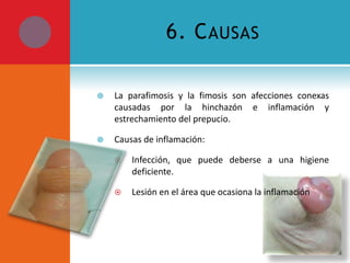 6. C AUSAS


La parafimosis y la fimosis son afecciones conexas
causadas por la hinchazón e inflamación y
estrechamiento del prepucio.



Causas de inflamación:


Infección, que puede deberse a una higiene
deficiente.



Lesión en el área que ocasiona la inflamación

 