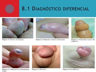 8.1 D IAGNÓSTICO DIFERENCIAL

 