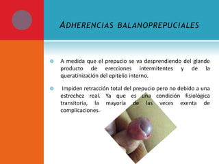 A DHERENCIAS

BALANOPREPUCIALES



A medida que el prepucio se va desprendiendo del glande
producto de erecciones intermitentes y de la
queratinización del epitelio interno.



Impiden retracción total del prepucio pero no debido a una
estrechez real. Ya que es una condición fisiológica
transitoria, la mayoría de las veces exenta de
complicaciones.

 