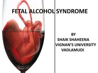 FETAL ALCOHOL SYNDROME
BY
SHAIK SHAHEENA
VIGNAN’S UNIVERSITY
VADLAMUDI
 