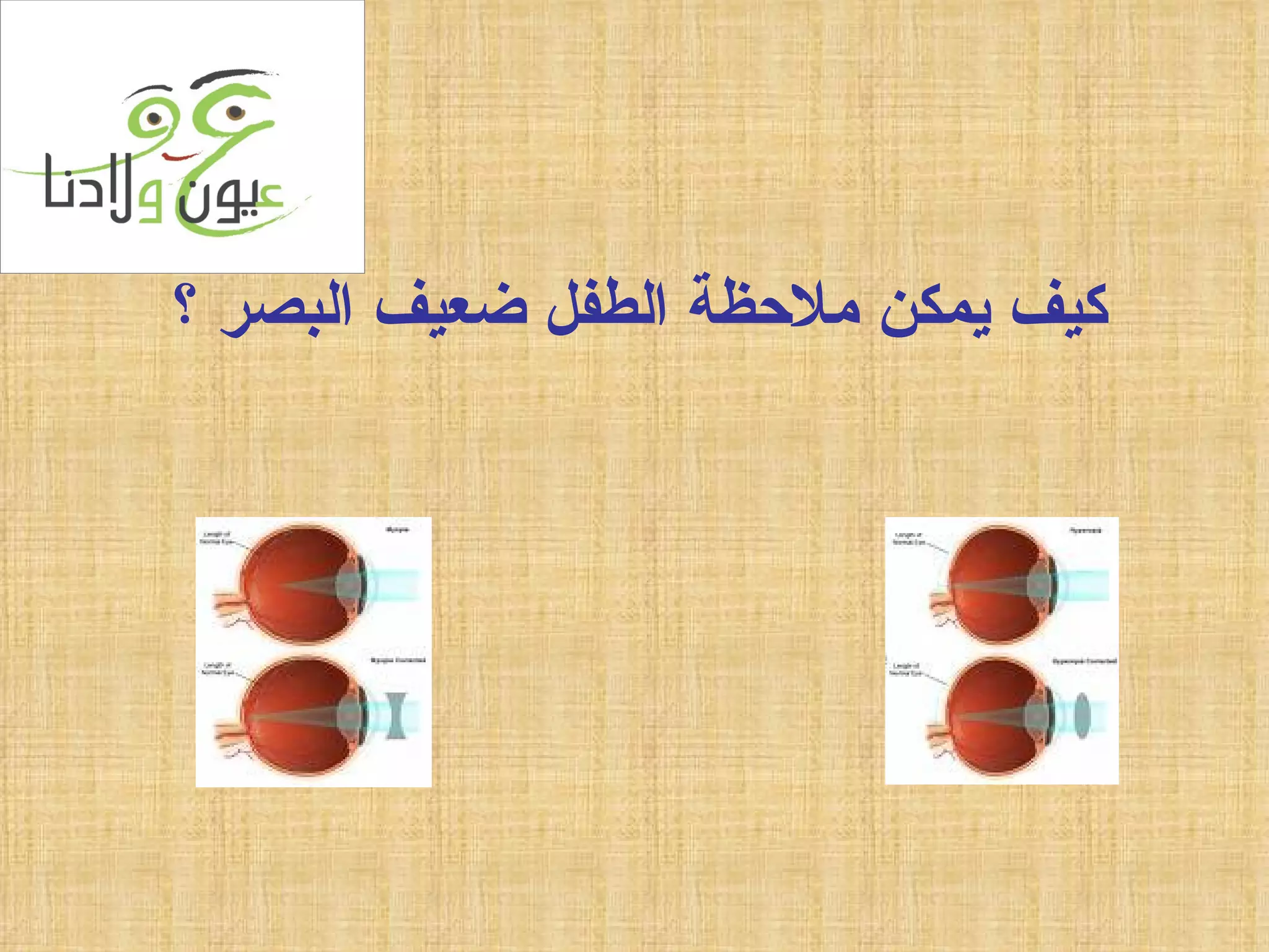 كيف يمكن ملاحظة الطفل ضعيف البصر ؟ 