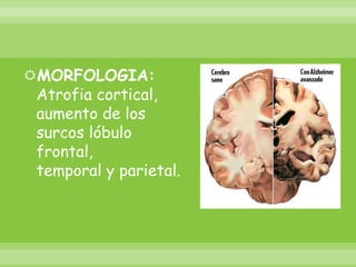 MORFOLOGIA: Atrofia cortical,aumento de los surcos lóbulo frontal, temporal y parietal.