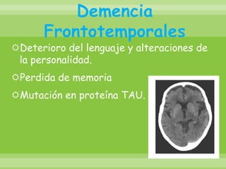 Demencia FrontotemporalesDeterioro del lenguaje y alteraciones de la personalidad.Perdida de memoriaMutación en proteína TAU. 