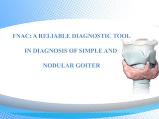 FNAC: A RELIABLE DIAGNOSTIC TOOL

   IN DIAGNOSIS OF SIMPLE AND

        NODULAR GOITER
 