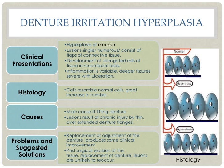 oral fibroma removal at home