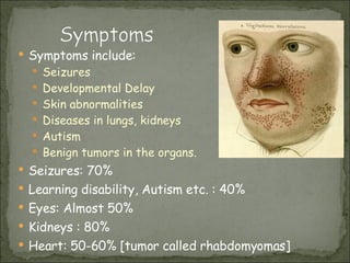 Symptoms include: Seizures Developmental Delay Skin abnormalities Diseases in lungs, kidneys Autism Benign tumors in the organs. Seizures: 70% Learning disability, Autism etc. : 40% Eyes: Almost 50% Kidneys : 80% Heart: 50-60% [tumor called rhabdomyomas] 