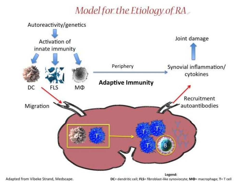 Rheumatoid Arthritis Early Diagnosis and Treatment
