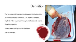 Definition of placenta Previa 
The term placenta previa refers to a placenta that overlies 
to the internal os of the cervix. The placenta normally 
implants in the upper uterine segment. In placenta previa, 
the placenta either 
totally or partially lies within the lower 
uterine segment. 
 