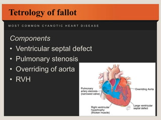 Approach to patient with congenital heart disease | PPTX