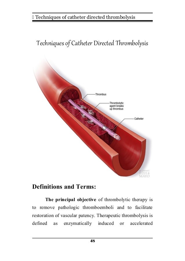 Role of thrombolyitc therapy in ttt of ALI